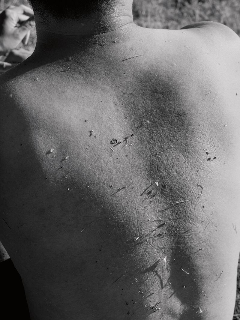 A black-and-white close-up of a person’s bare back, covered with indentations from grass and bits of dirt and grass.